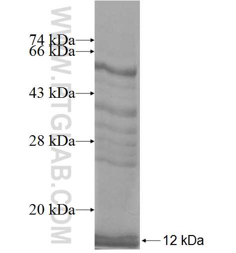 INPP4B fusion protein Ag8689 SDS-PAGE INPP4B fusion protein Ag8689 SDS-PAGE