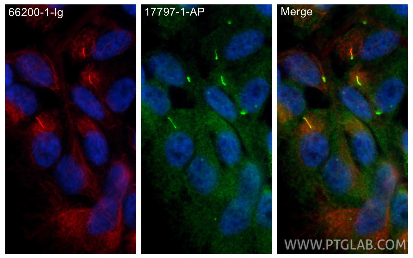 IF Staining of hTERT-RPE1 using 17797-1-AP