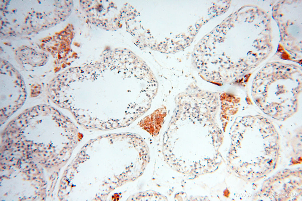 IHC staining of human testis using 17797-1-AP