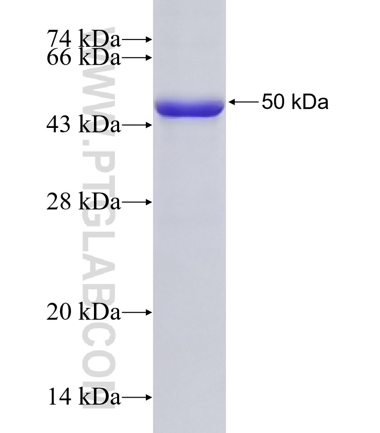 INPP5E fusion protein Ag32682 SDS-PAGE INPP5E fusion protein Ag32682 SDS-PAGE