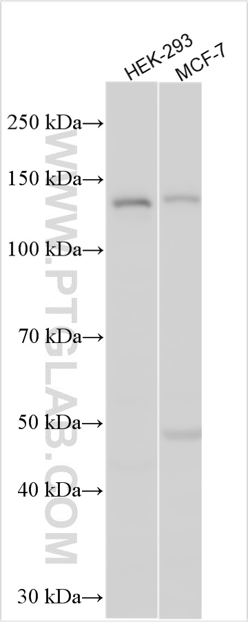 WB analysis using 27240-1-AP