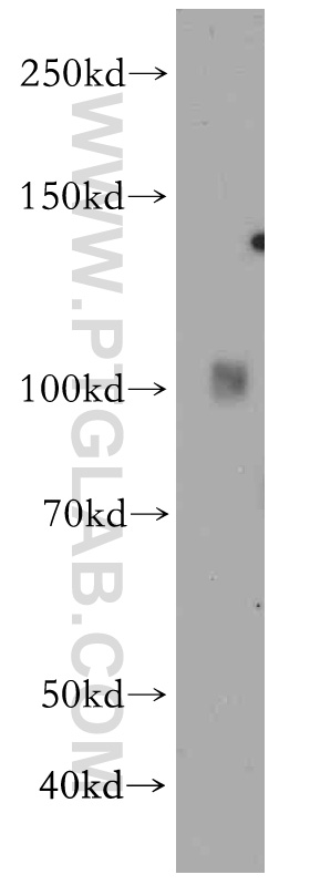 WB analysis of human heart using 21417-1-AP