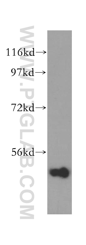 WB analysis of HEK-293 using 15098-1-AP