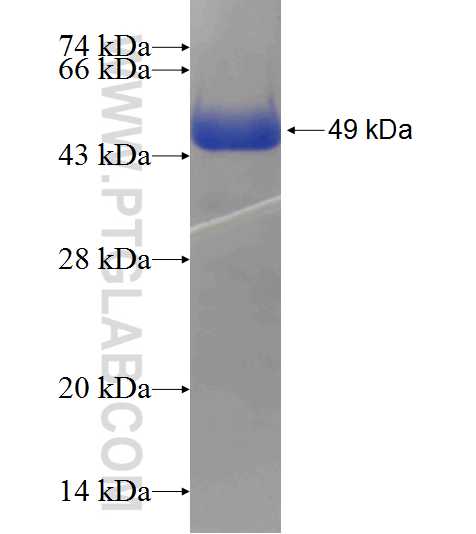 INPPL1 fusion protein Ag24790 SDS-PAGE