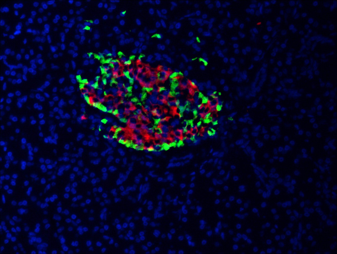 IF Staining of human pancreas using 15848-1-AP