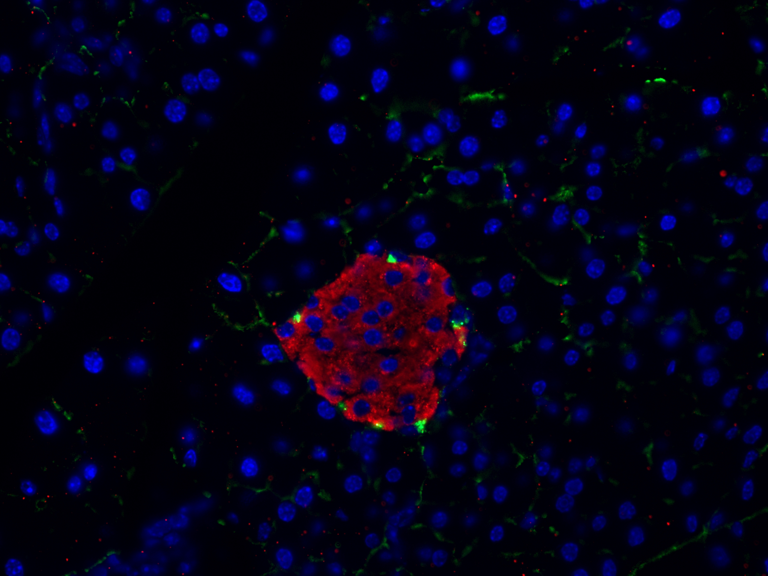 IF Staining of mouse pancreas using 15848-1-AP