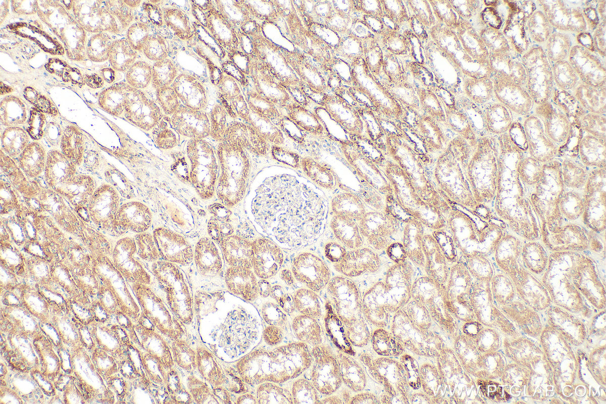 Immunohistochemical analysis of paraffin-embedded human kidney tissue slide using 20973-1-AP (INSC antibody) at dilution of 1:200 (under 10x lens). Heat mediated antigen retrieval with Tris-EDTA buffer (pH 9.0). IHC staining of human kidney using 20973-1-AP
