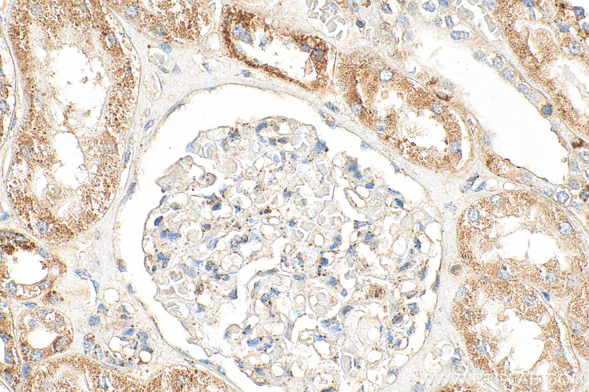 Immunohistochemical analysis of paraffin-embedded human kidney tissue slide using 20973-1-AP (INSC antibody) at dilution of 1:200 (under 40x lens). Heat mediated antigen retrieval with Tris-EDTA buffer (pH 9.0). IHC staining of human kidney using 20973-1-AP