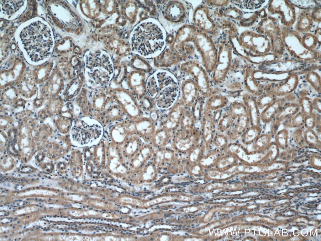 IHC staining of human kidney using 20973-1-AP