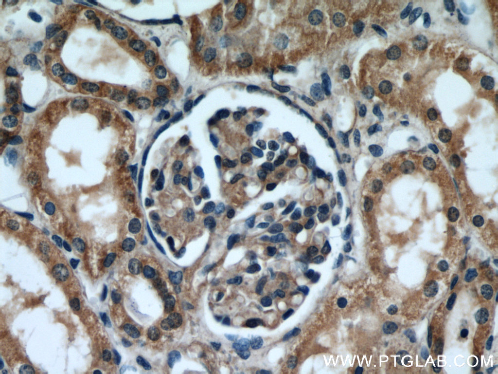 IHC staining of human kidney using 20973-1-AP