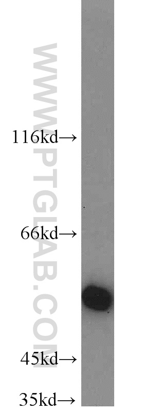 WB analysis of mouse liver using 20973-1-AP