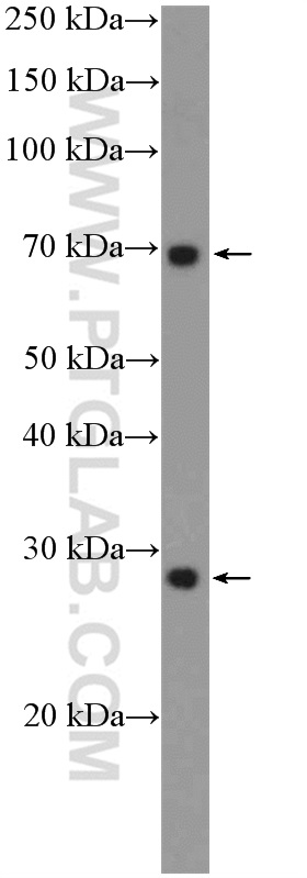 WB analysis of A549 using 22115-1-AP