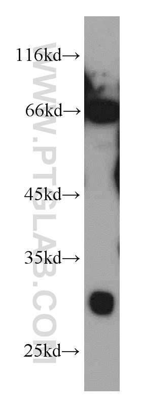 INSIG1 Polyclonal antibody