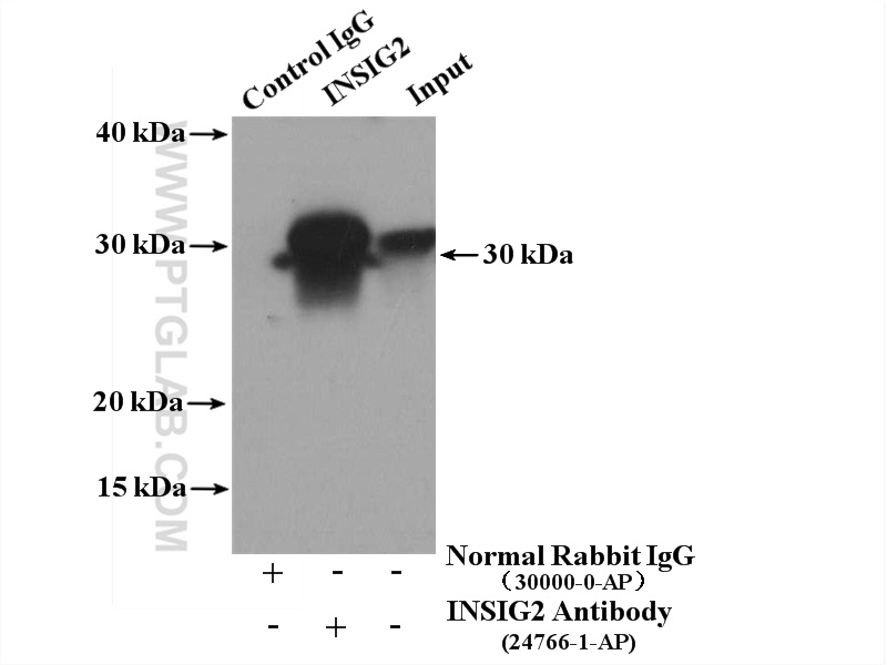 IP experiment of mouse liver using 24766-1-AP