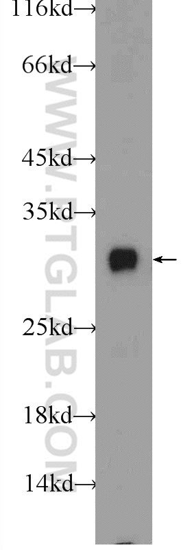 WB analysis of rat liver using 24766-1-AP