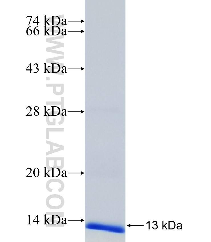 INSIG2 fusion protein Ag14279 SDS-PAGE INSIG2 fusion protein Ag14279 SDS-PAGE