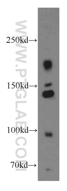 INSR Polyclonal antibody