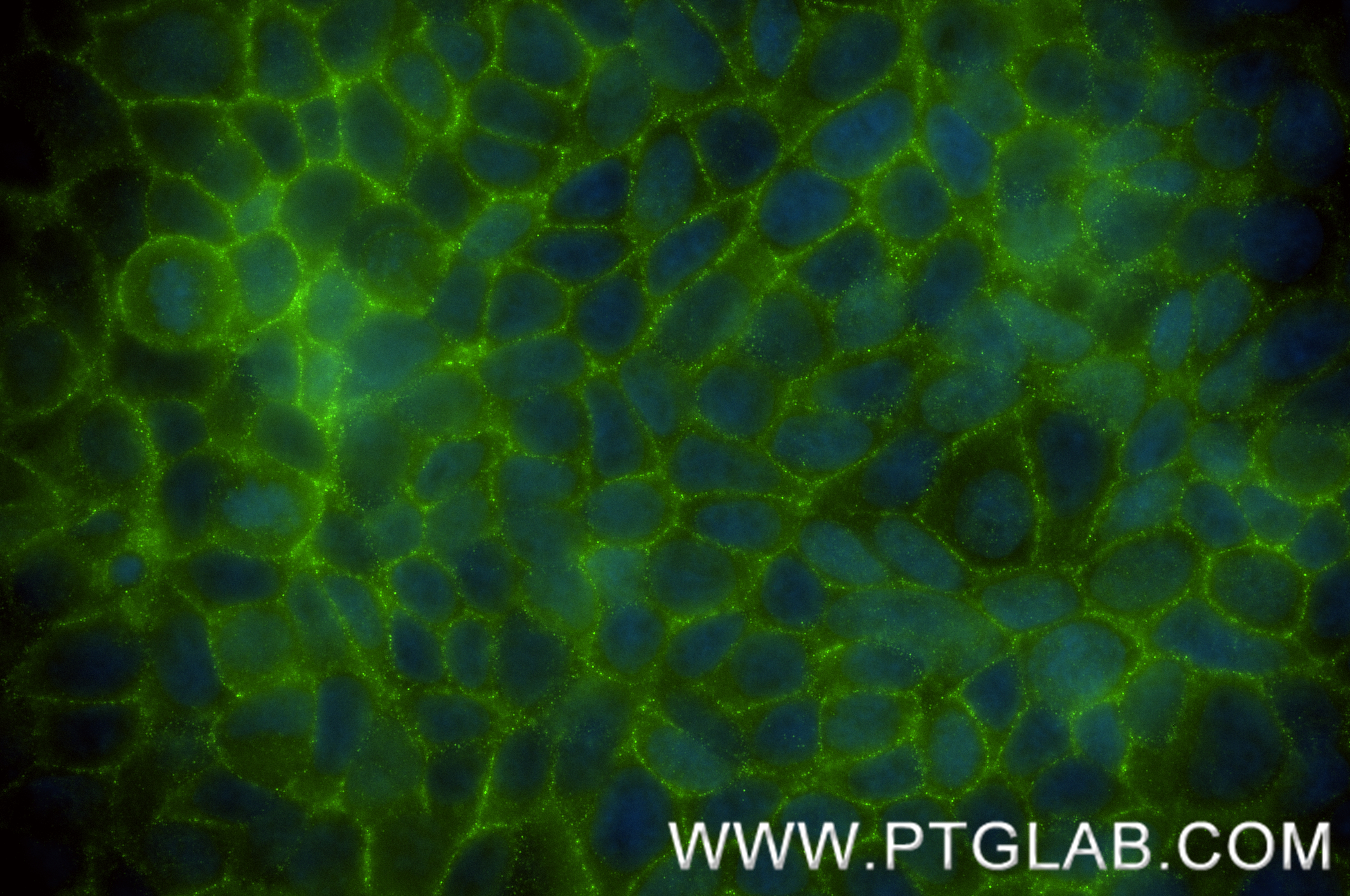 IF Staining of MCF-7 using 84467-2-RR