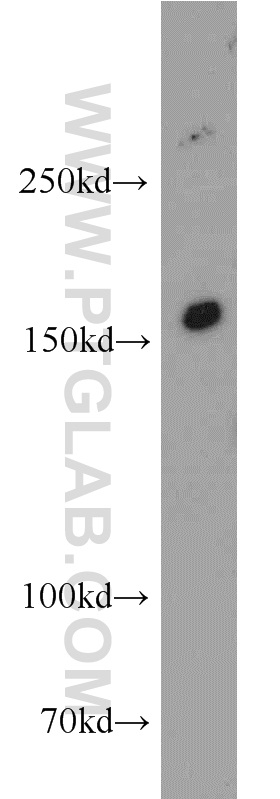 WB analysis of mouse kidney using 55112-1-AP