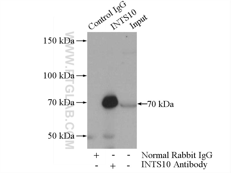 IP experiment of HeLa using 15271-1-AP