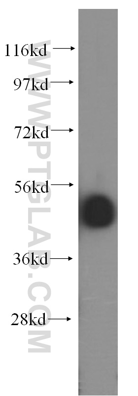 WB analysis of HepG2 using 16455-1-AP