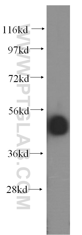 WB analysis of HepG2 using 16455-1-AP