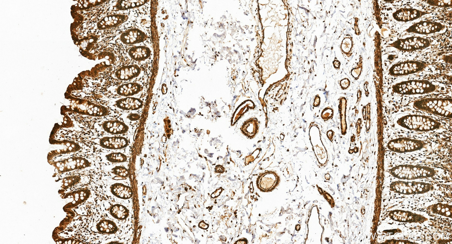 IHC staining of human colon using 16130-1-AP IHC staining of human colon using 16130-1-AP