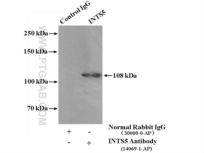 IP experiment of HeLa using 14069-1-AP