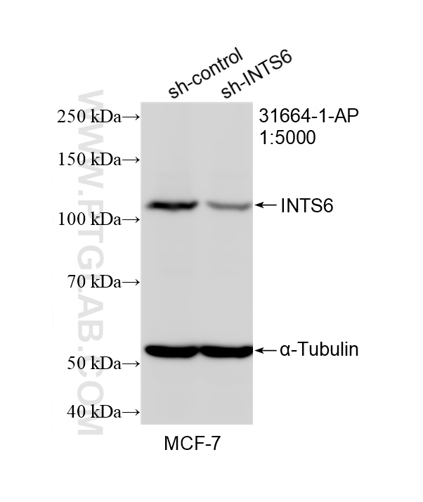 WB result of INTS6 antibody (31664-1-AP; 1:5000; incubated at room temperature for 1.5 hours) with sh-Control and sh-INTS6 transfected MCF-7 cells. WB analysis of MCF-7 using 31664-1-AP
