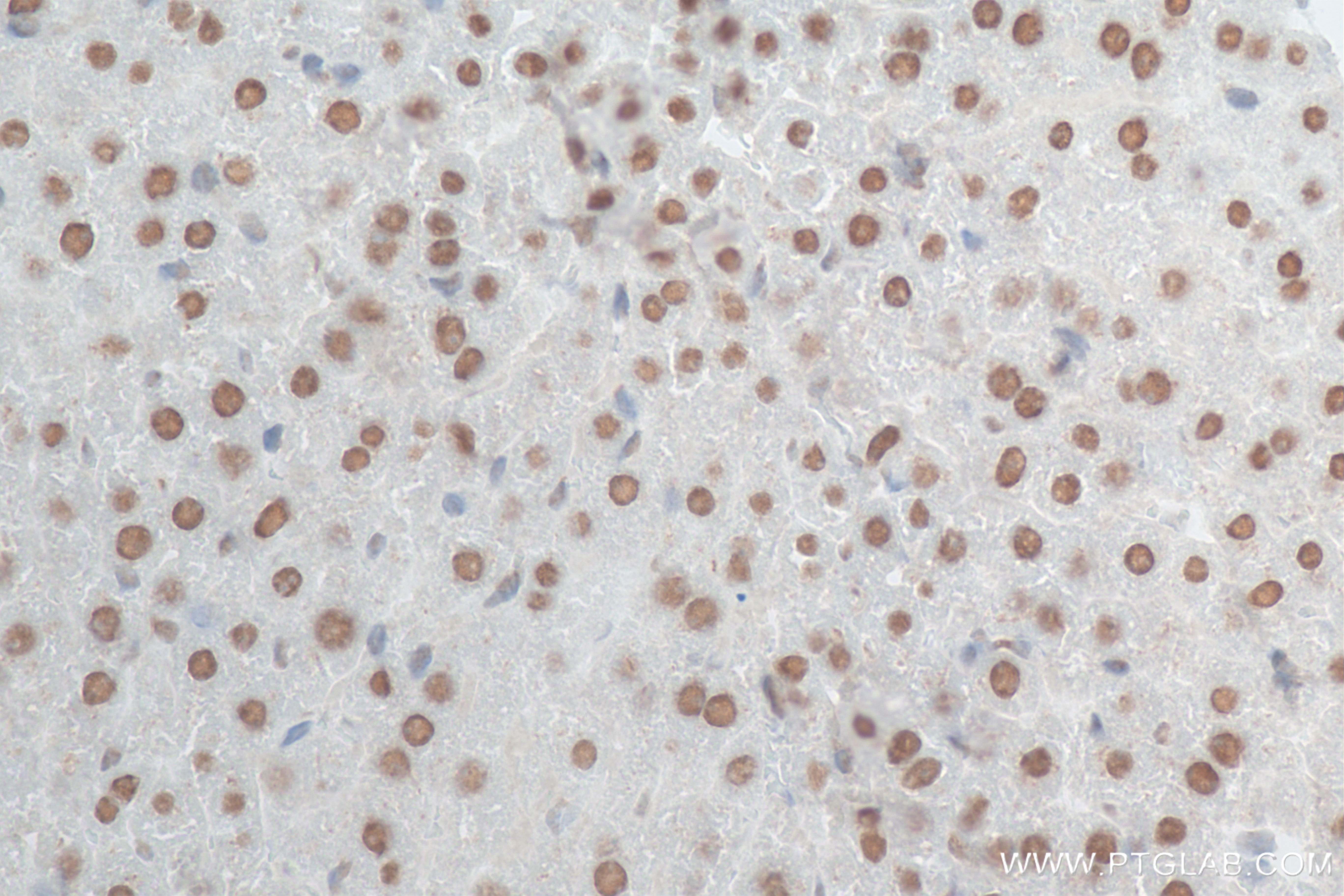IHC staining of mouse liver using 84610-3-RR
