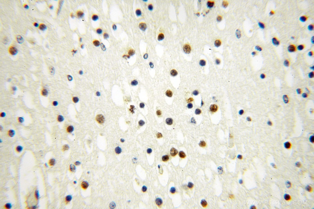 IHC staining of human brain using 17054-1-AP