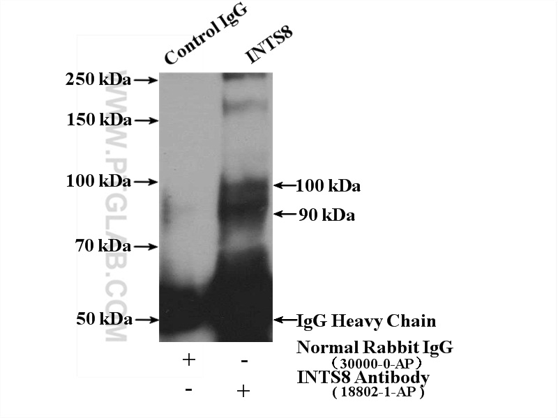 IP experiment of HeLa using 18802-1-AP