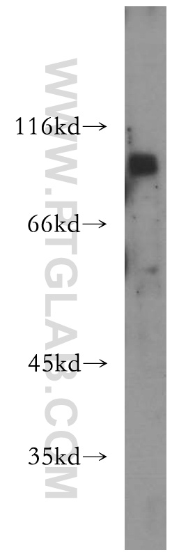 WB analysis of MCF-7 using 18802-1-AP