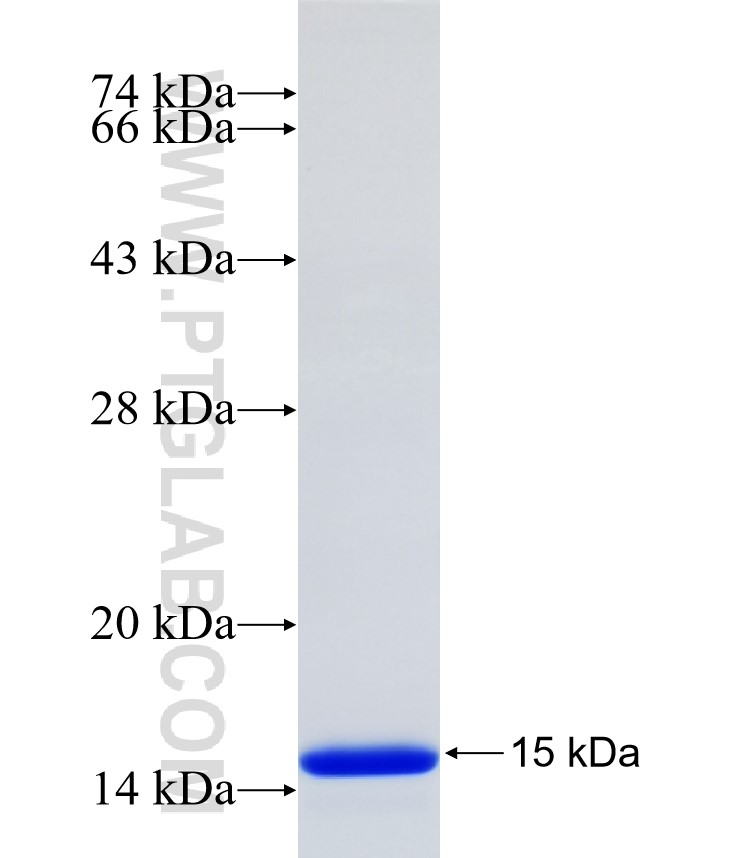INTS8 fusion protein Ag34600 SDS-PAGE INTS8 fusion protein Ag34600 SDS-PAGE