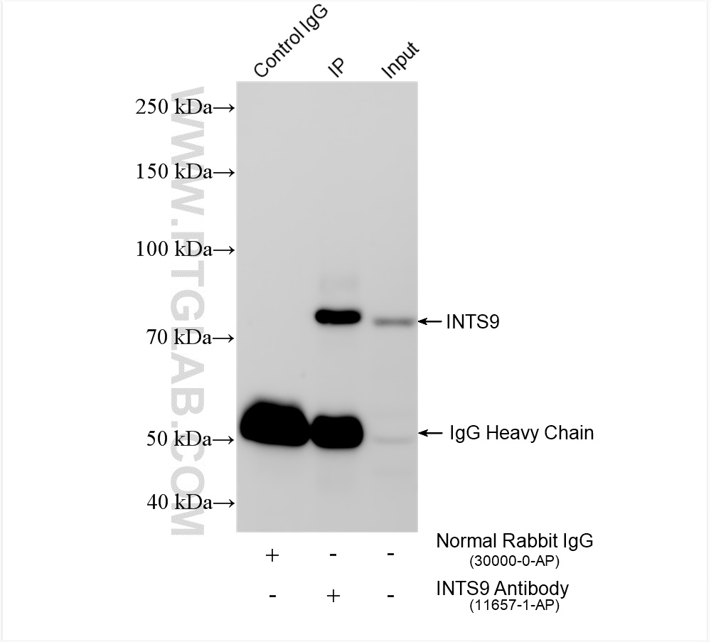 IP experiment of HeLa using 11657-1-AP