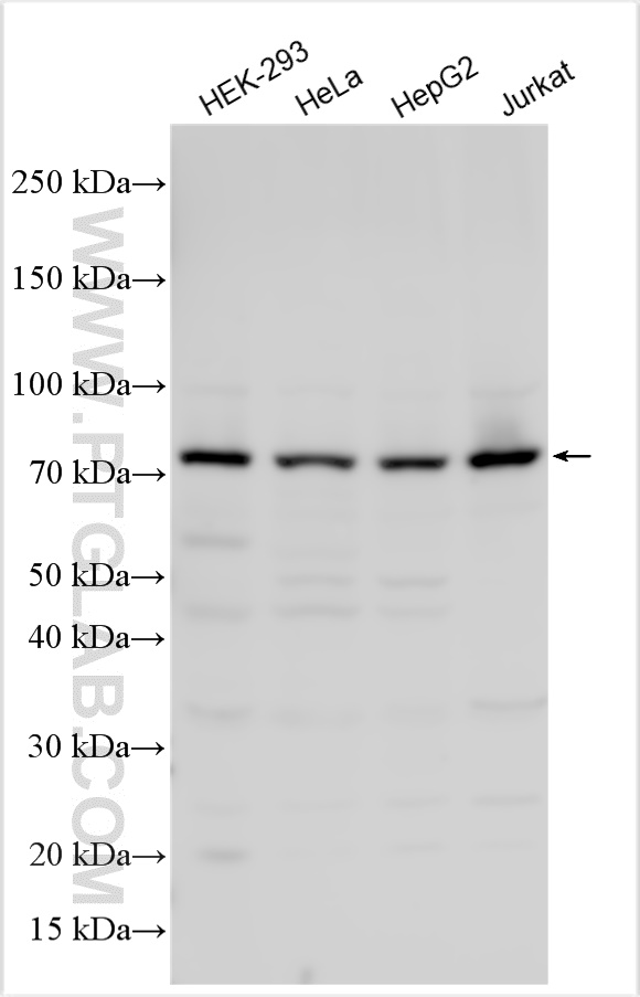 WB analysis using 11657-1-AP