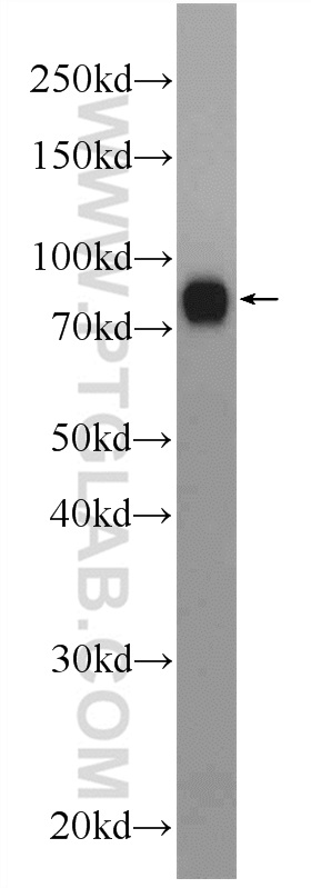 WB analysis of mouse liver using 24914-1-AP