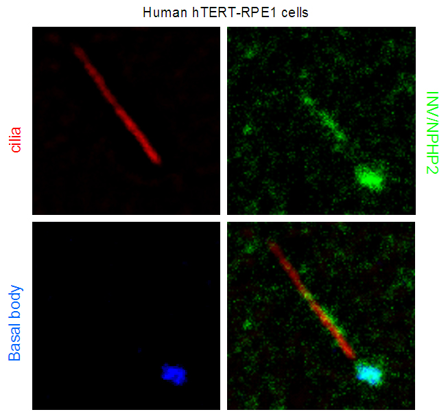 IF Staining of hTERT-RPE1 cells using 10585-1-AP