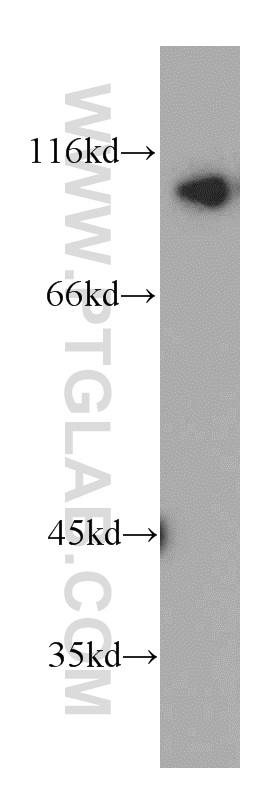 INVS Polyclonal antibody