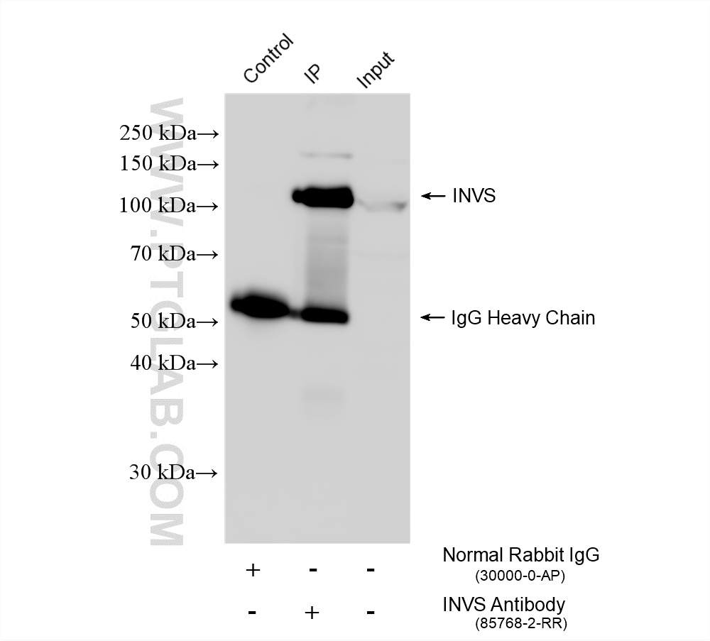 IP experiment of K-562 using 85768-2-RR