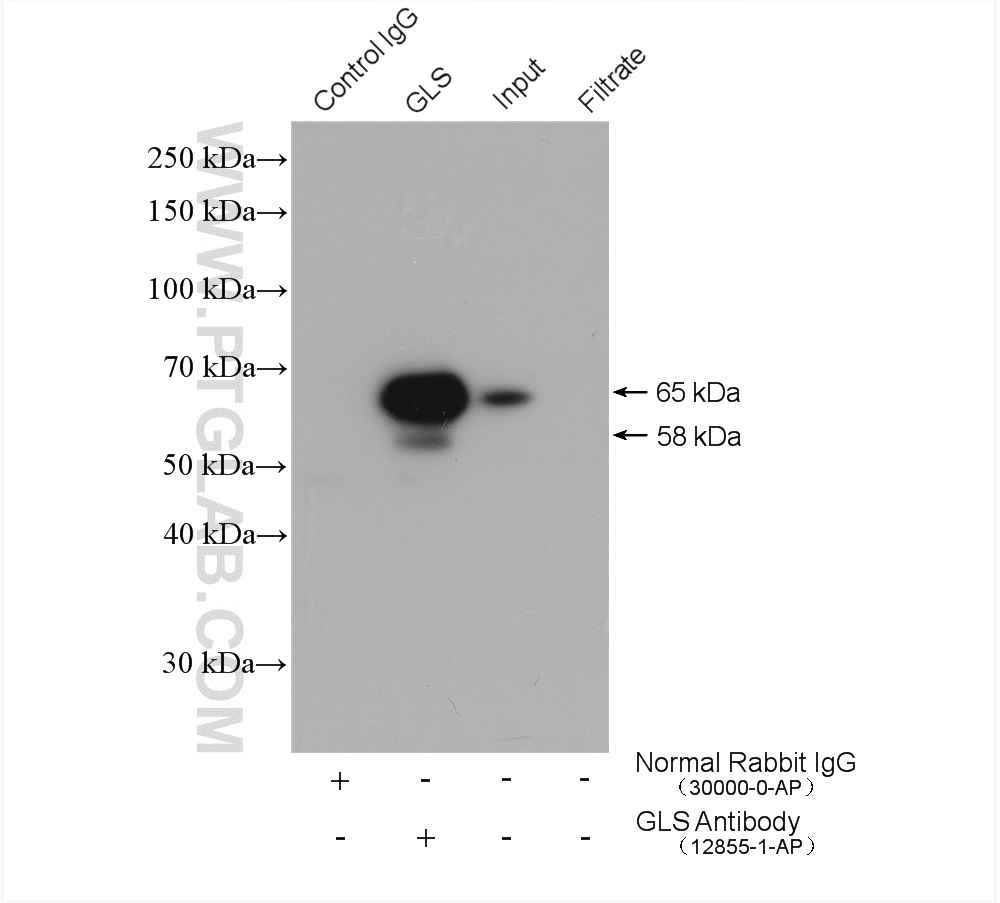 IP result of anti-KGA/GAC (IP:12855-1-AP, 4ug; Detection:12855-1-AP 1:5000) with mouse brain tissue lysate 2400 ug.