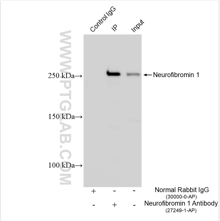 IP result of anti-Neurofibromin 1 (IP: 27249-1-AP, 4 ug; Detection: 27249-1-AP 1:1000) with HEK-293 cells lysate 1800 ug.