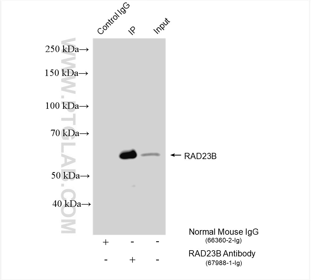 IP result of anti-RAD23B (IP: 67988-1-Ig, 4 ug; Detection: 67988-1-Ig 1:4000) with mouse testis tissue lysate 1560 ug.