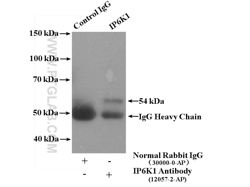IP experiment of mouse kidney using 12057-2-AP