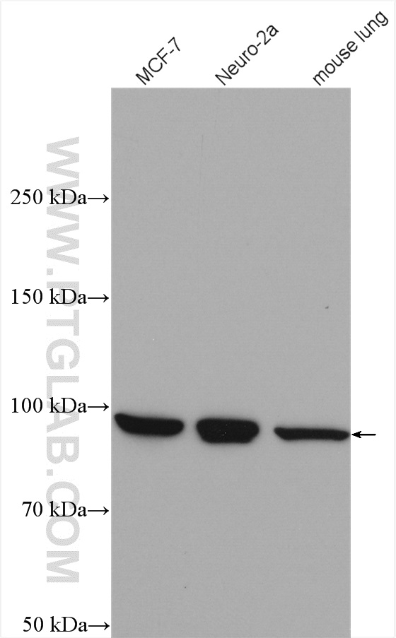 WB analysis using 11696-2-AP