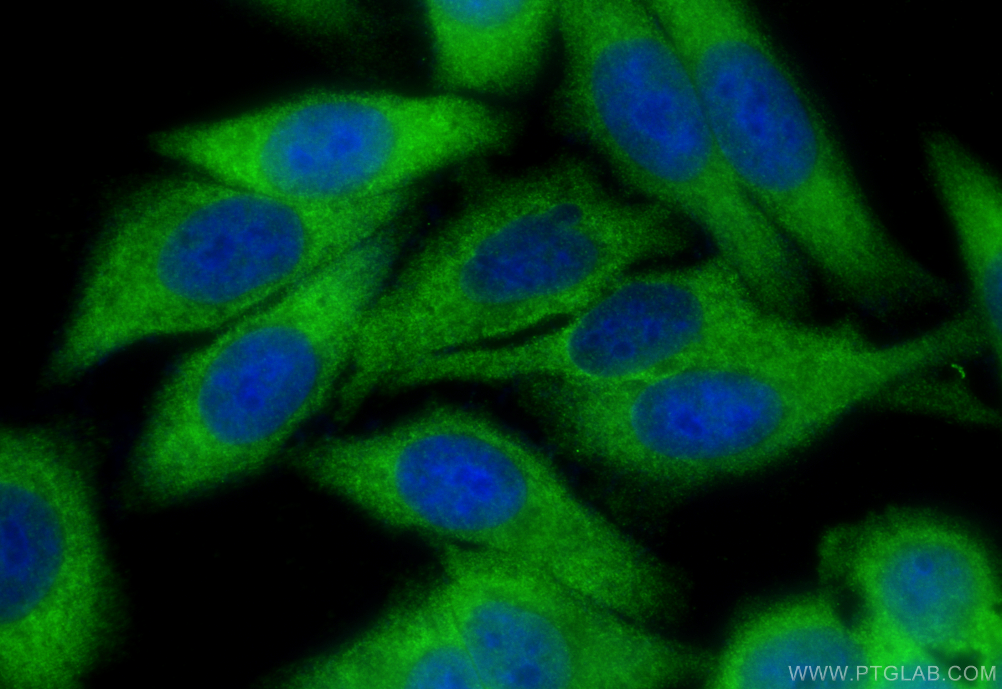 IF Staining of HepG2 using 11679-1-AP