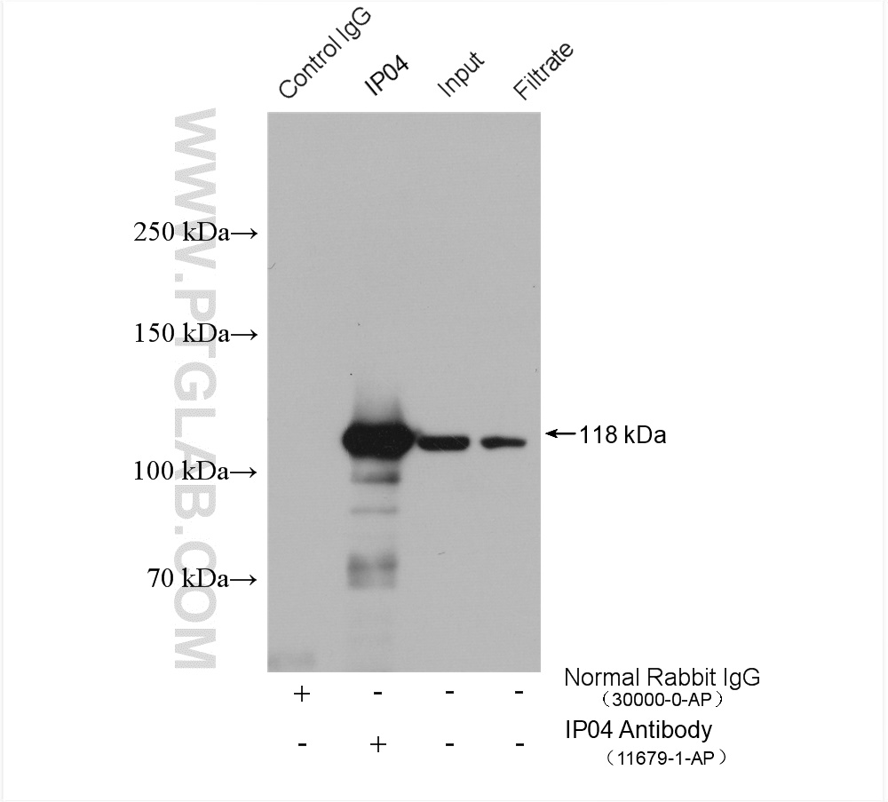 IP experiment of mouse testis using 11679-1-AP