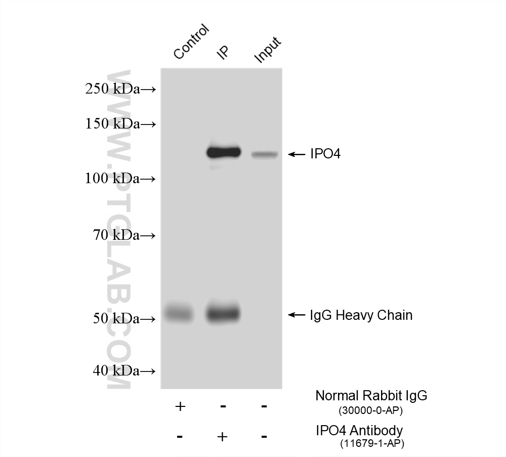 IP experiment of mouse testis using 11679-1-AP