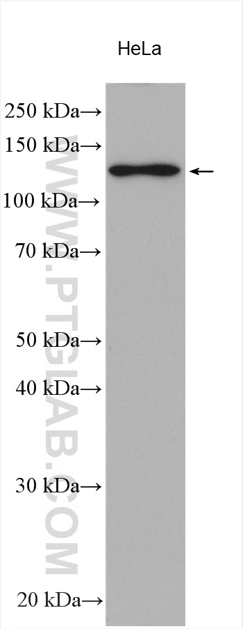 WB analysis using 11679-1-AP