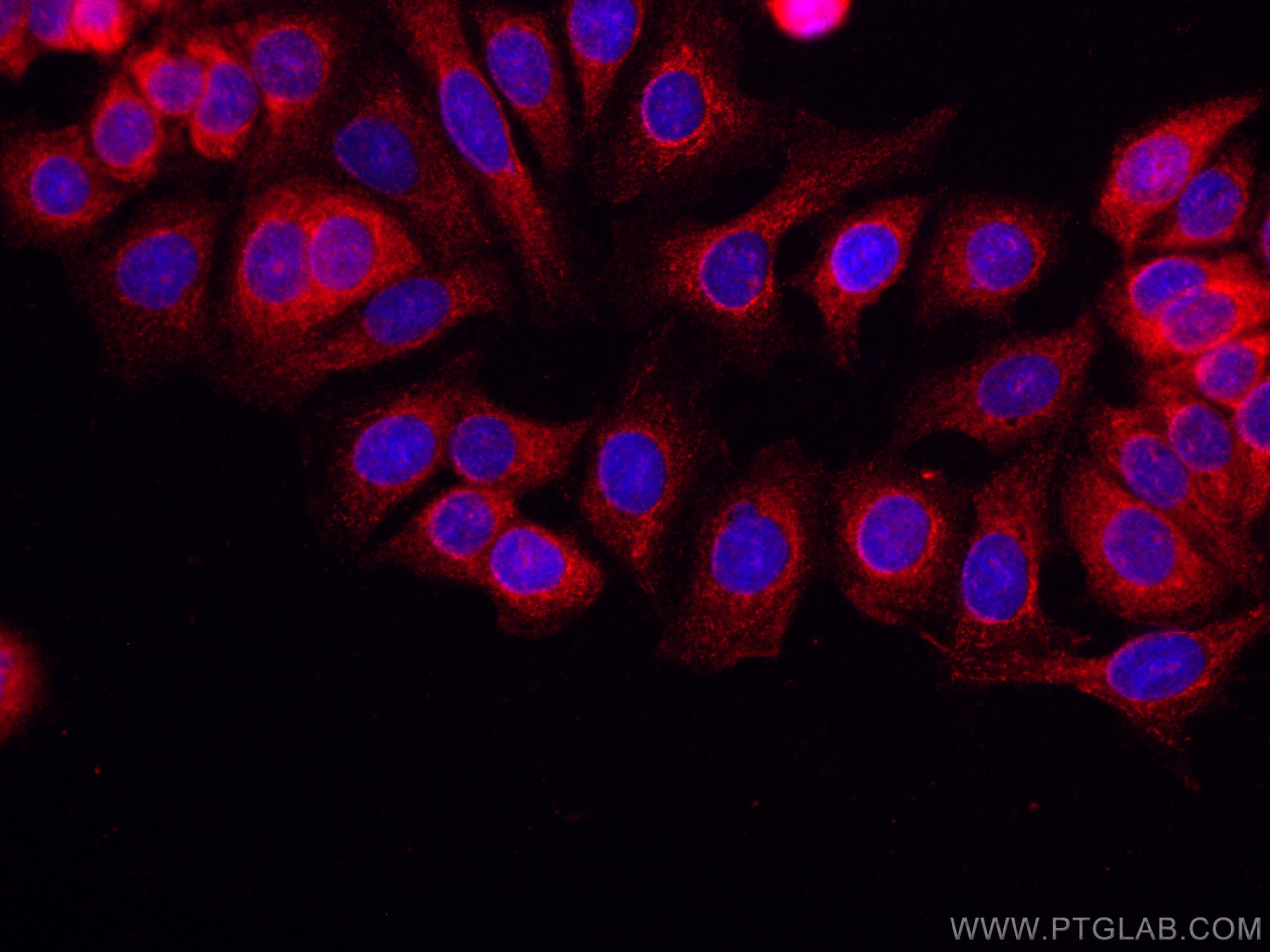 IF Staining of MCF-7 using CL594-67549